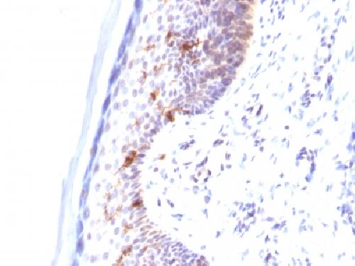 CD1A Antibody