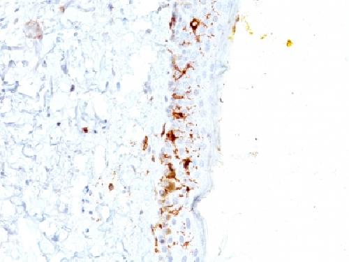 CD1A Antibody