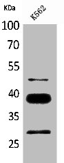 CD1D Antibody