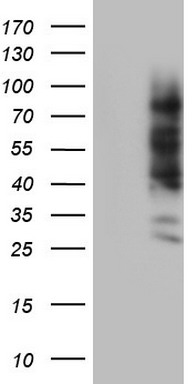 CD20 Antibody