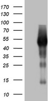 CD20 Antibody