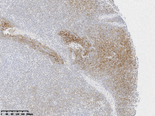 CD21 Antibody