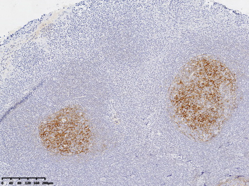 CD21 Antibody
