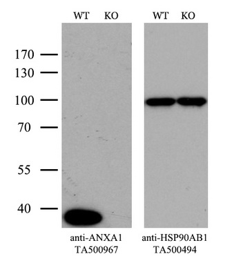 CD21 Antibody