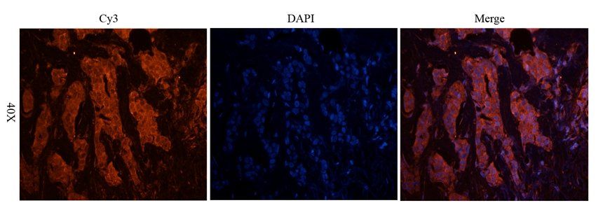 CD213a2 Rabbit Polyclonal Antibody