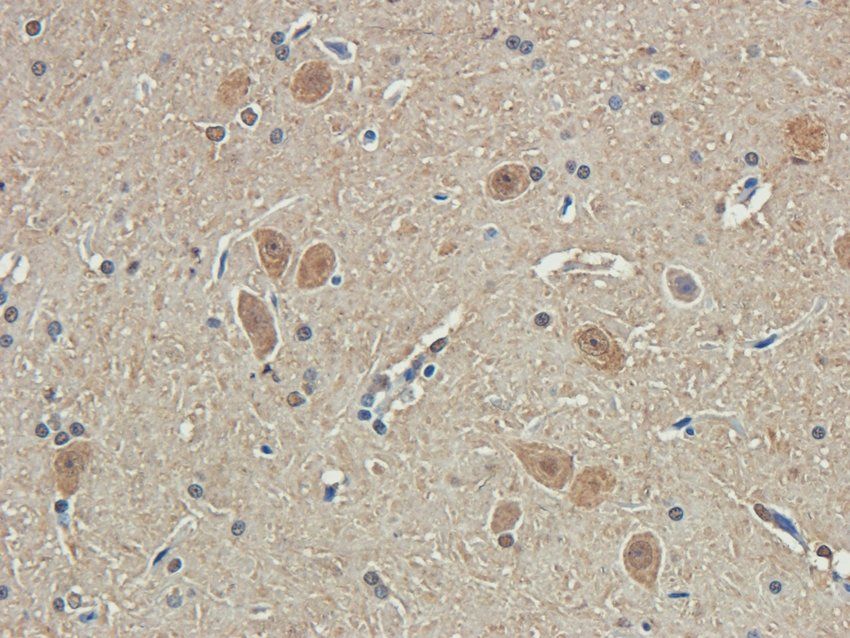 CD213a2 Rabbit Polyclonal Antibody