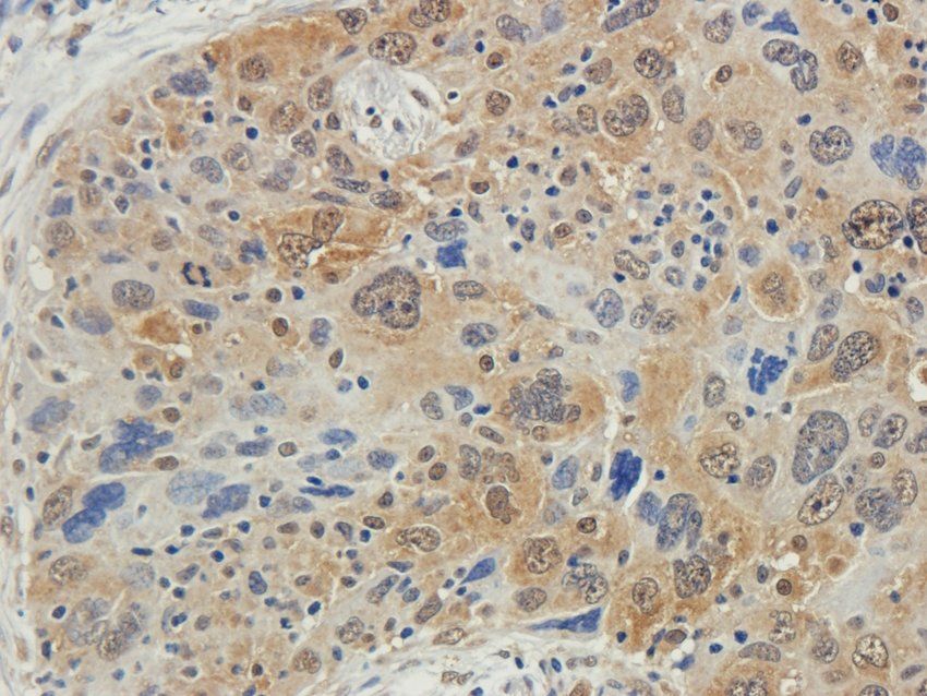 CD213a2 Rabbit Polyclonal Antibody