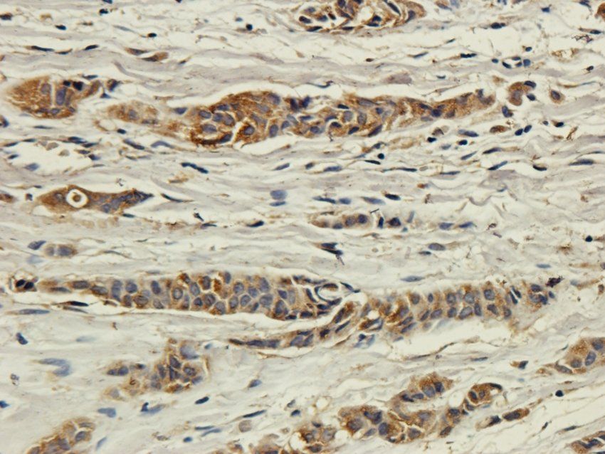 CD213a2 Rabbit Polyclonal Antibody