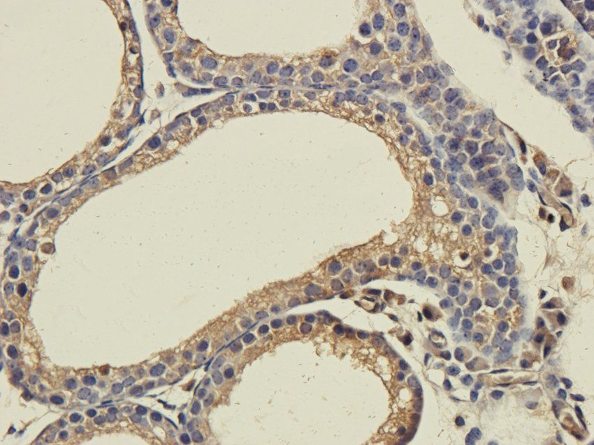 CD213a2 Rabbit Polyclonal Antibody