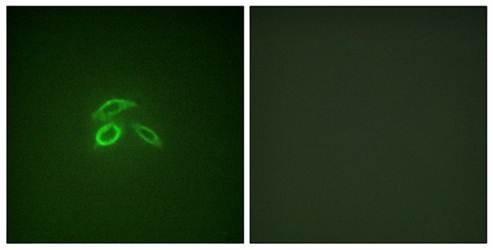 CD227/MUC1 (Phospho-Tyr1229) Antibody