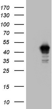 CD23 Antibody