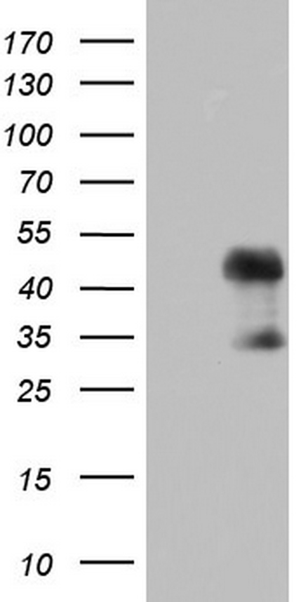 CD23 Antibody