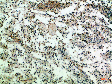 CD247 Antibody