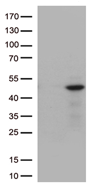 CLEC4M Antibody