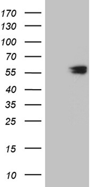 CLEC4M Antibody