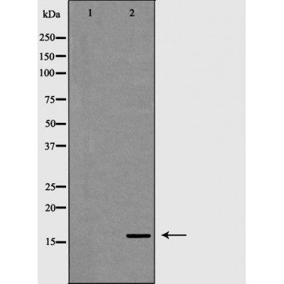 CD3 zeta Antibody