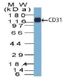 CD31 / PECAM-1 (Endothelial Cell Marker) Antibody