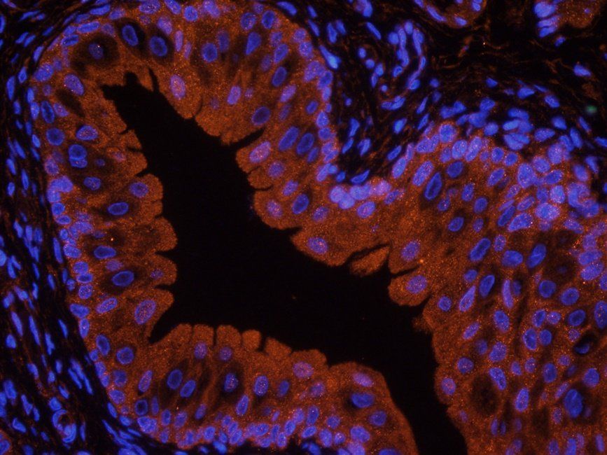 CD32b Rabbit Polyclonal Antibody