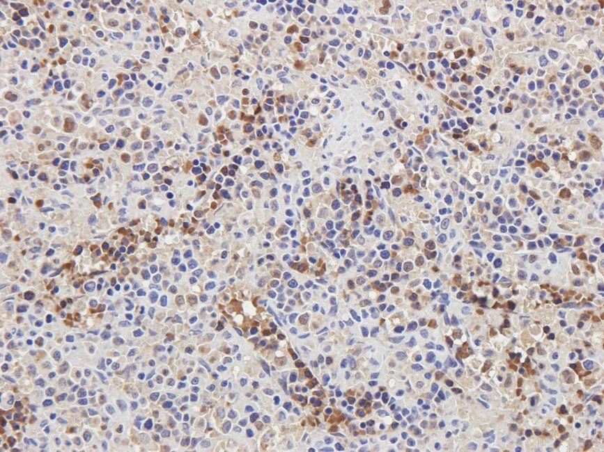 CD32b Rabbit Polyclonal Antibody