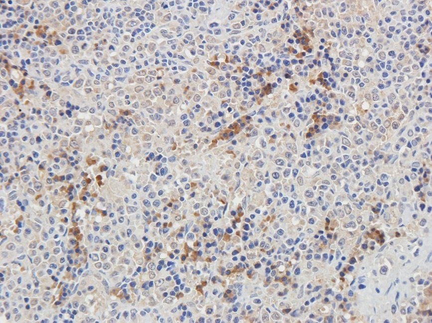 CD32b Rabbit Polyclonal Antibody