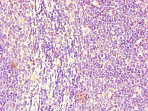 FCGR2B Antibody