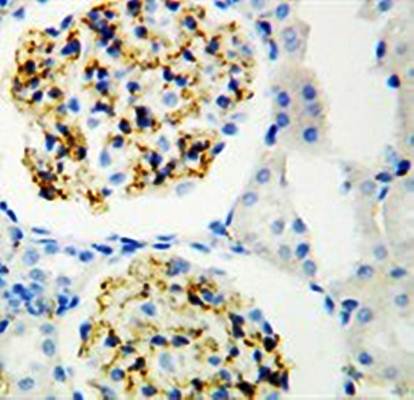 CD34 Rabbit Polyclonal Antibody