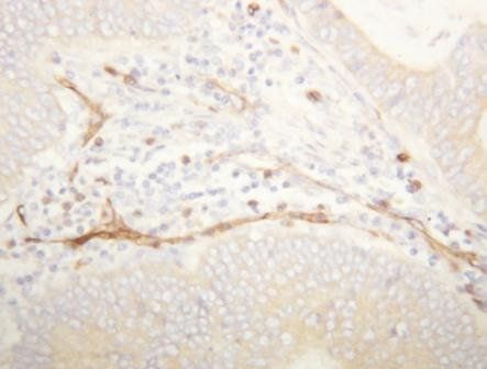 CD34 Rabbit Polyclonal Antibody