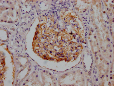 CR1 Antibody