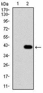 CD36 Antibody