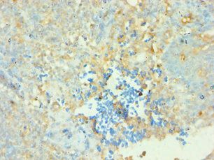 CD38 Antibody