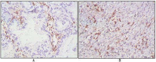 CD38 Antibody