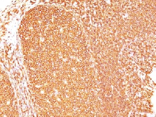 CD45RB (B-Cell Marker) Antibody