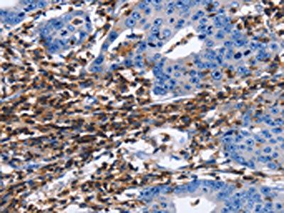 PTPRC Antibody