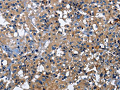 CD46 Antibody