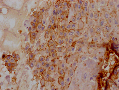 CD55 Antibody