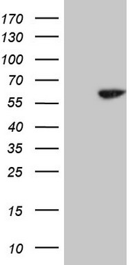 CD56 Antibody