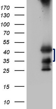 CD56 Antibody
