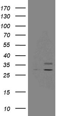 CD56 Antibody