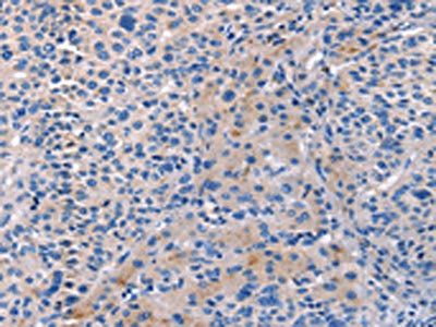 CD5L Antibody