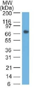 CEACAM5 Antibody