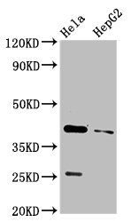 CD72 Antibody