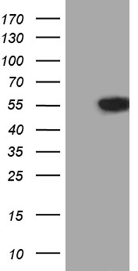 CD79B Antibody