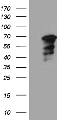 CD79B Antibody