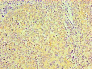 CD81 Antibody