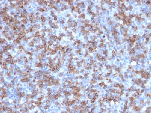 Recombinant CD8A (Cytotoxic- & Suppressor T-Cell Marker) Antibody