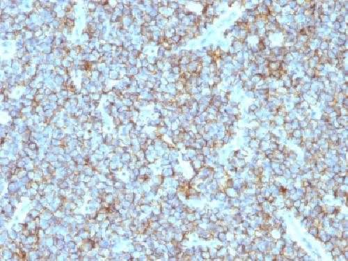 CD99 Antibody