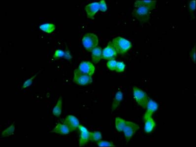 CDAN1 Antibody