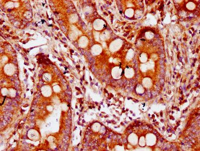 CDAN1 Antibody