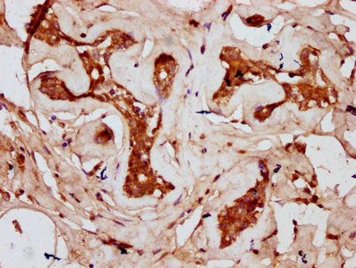 CDAN1 Antibody