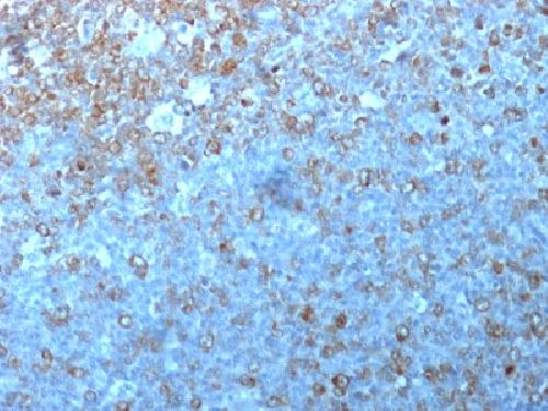 CDK1 Antibody